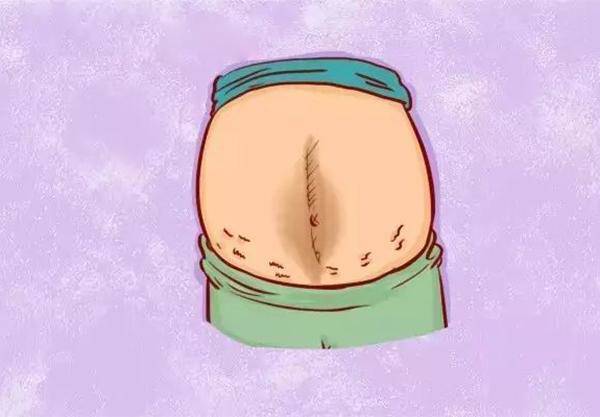 4 bộ phận càng xấu xí khi mẹ mang bầu, xin chúc mừng vì thai nhi càng khỏe mạnh - 2