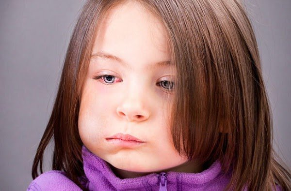 Triệu chứng quai bị ở trẻ em dễ nhận biết nhất - 3