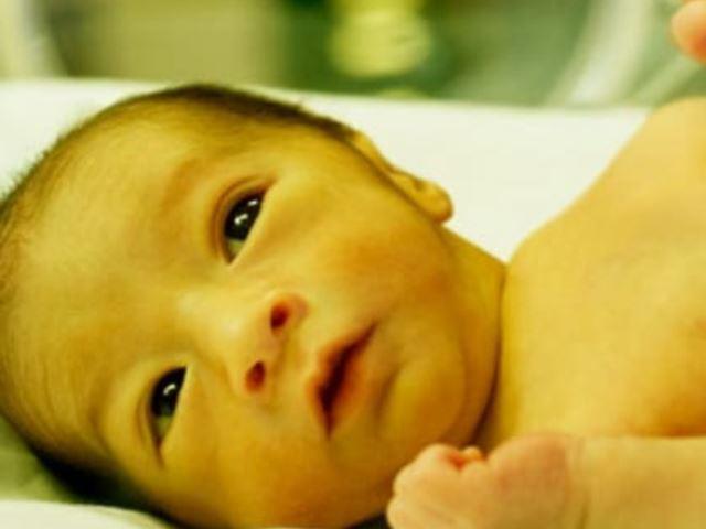 Chỉ số bilirubin vàng da ở trẻ sơ sinh như thế nào được coi là nguy hiểm?