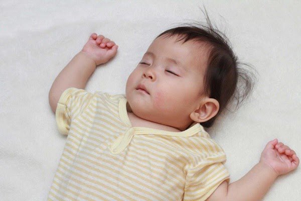 Cách hạ sốt cho trẻ bị viêm họng hiệu quả và an toàn nhất - 2