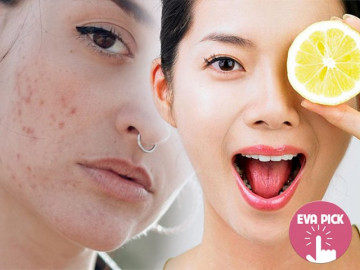 Bỏ ra 10 nghìn đồng mua mấy nguyên liệu tự nhiên này, sẹo thâm mụn dễ dàng bị đánh bay