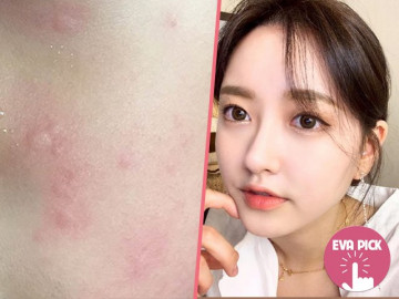 5 thành phần thường gặp trong mỹ phẩm ngày ngày tàn phá làn da, thúc đẩy lão hóa sớm