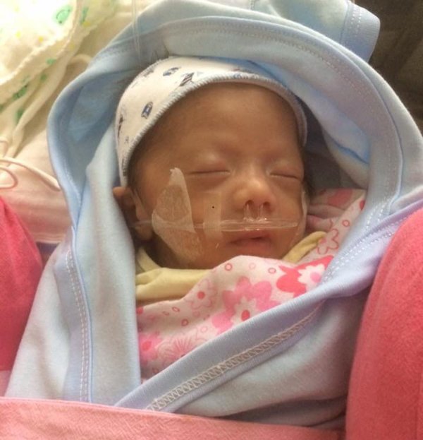 9x yen bai khoe vet mo de nhu con ret giua bung, nhin anh thoi son tre ma xot xa - 4