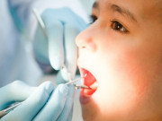 Làm mẹ - Nếu cha mẹ không bỏ ngay quan niệm sai lầm này, răng của con sẽ sớm sún hỏng cả hàm