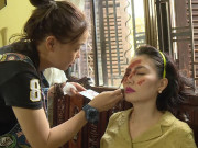 Giải trí - Cận cảnh khuôn mặt "biến dạng" kinh dị nhất sự nghiệp của Ngọc Lan sau khi bị tạt axit