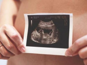 Dấu hiệu thai 11 tuần khỏe mạnh và những điều mẹ cần làm để con phát triển tốt nhất