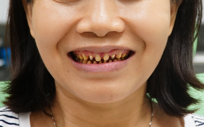 Bệnh viện JW ưu đãi khủng đến 50% toàn bộ dịch vụ răng hàm mặt - 1