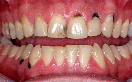 Bệnh viện JW ưu đãi khủng đến 50% toàn bộ dịch vụ răng hàm mặt - 2