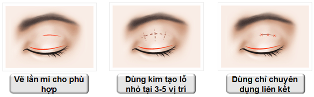 Tìm ra bộ phận trụ nhan của Lý Nhã Kỳ, không phải cặp má mà là amp;#34;cửa sổ tâm hồnamp;#34; - 6