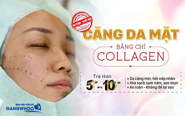 Da mặt căng mịn không cần phẫu thuật chỉ 45 phút tại Bệnh viện Gangwhoo - 1