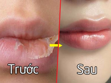 Là con gái, nàng nhất định nên nắm vững những bí quyết dưỡng môi đơn giản này