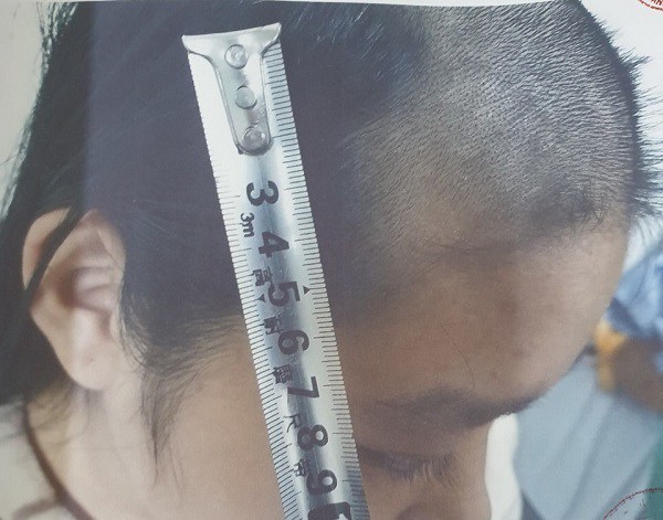 Bố mẹ ly hôn, bé gái ở Bắc Ninh bị bố bắt nghỉ học, thường xuyên đánh đập dã man - 1