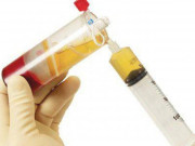 Sức khỏe - Tin "động trời" về việc làm giảm hiệu quả vắc xin của biến thể SARS-CoV-2 mới