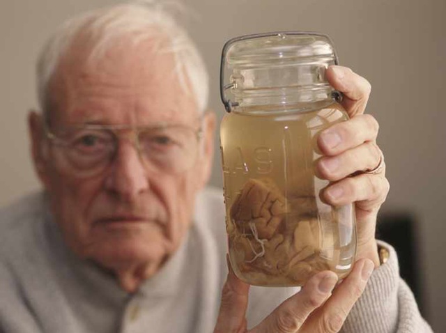 Cái chết của Albert Einstein và hành trình bộ não thiên tài bậc nhất thế giới bị đánh cắp - 3