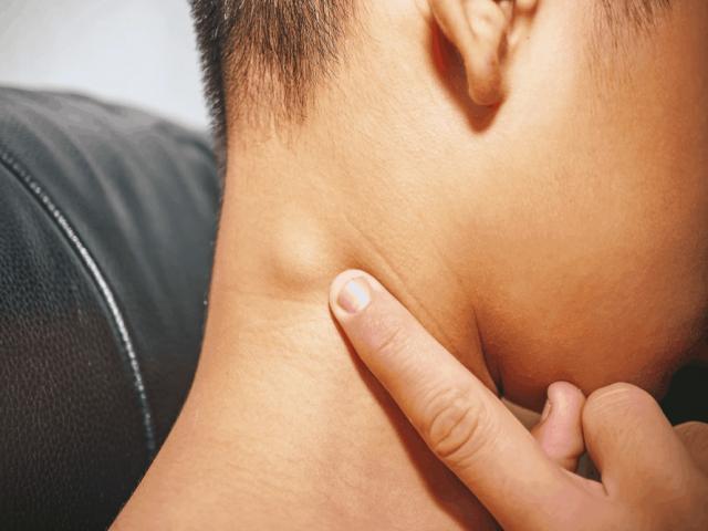 Khi nào nổi hạch là dấu hiệu ung thư? Nổi hạch kèm dấu hiệu này nên đi khám gấp