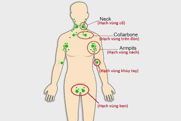 Phương pháp chẩn đoán