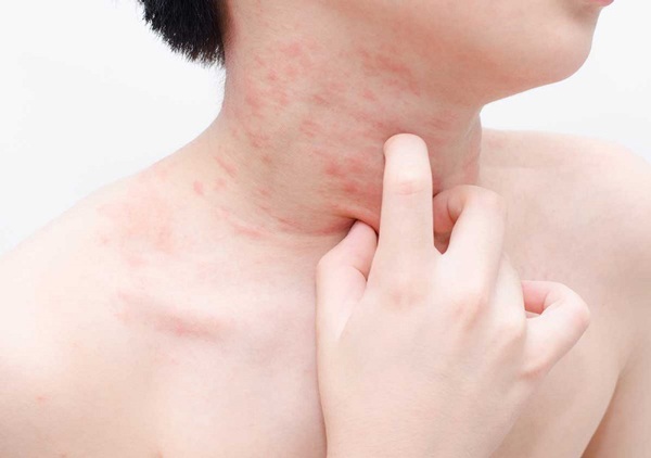 Những dấu hiệu cảnh báo bạn nên dừng ăn mật ong ngay, đặc biệt đối tượng này cấm kị ăn - 2