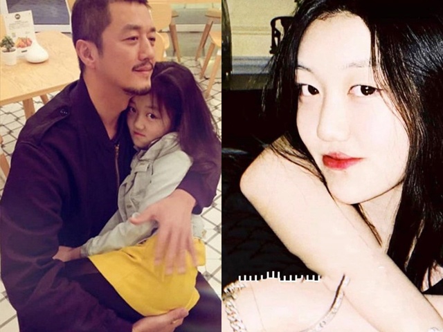 Con gái Lý Á Bằng: Bức xúc vì bức ảnh lộ dị tật hở hàm ếch, nỗi đau trỗi dậy