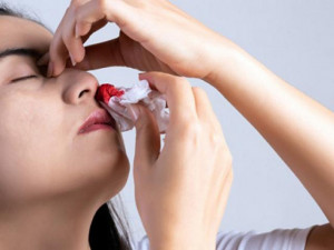 Chảy máu cam mỗi khi 