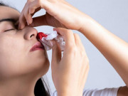 Sức khỏe - Chảy máu cam mỗi khi "đèn đỏ", bác sĩ lý giải nguyên nhân do bệnh phụ khoa lan tới mũi