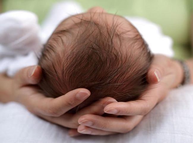 Hội chứng đầu phẳng ở trẻ sơ sinh: 3 việc mẹ cần làm sớm để tránh hậu họa - 5