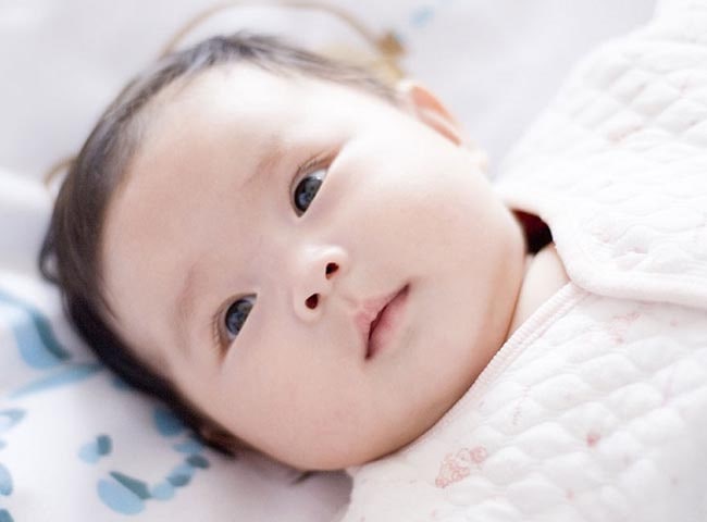 Hội chứng đầu phẳng ở trẻ sơ sinh: 3 việc mẹ cần làm sớm để tránh hậu họa - 9