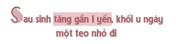 2 năm sau ca amp;#34;mổ ngồiamp;#34; được cả nước theo dõi, mẹ bé Bình An tăng 10kg, hồng hào hơn - 10