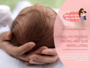 Làm mẹ - Hội chứng đầu phẳng ở trẻ sơ sinh: 3 việc mẹ cần làm sớm để tránh hậu họa