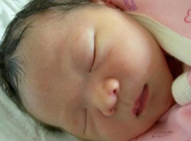Con mới sinh 6 ngày chưa mở mắt, mẹ vội đi khám mới biết do di truyền - 1