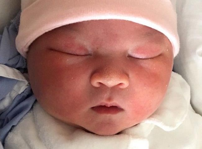 Con mới sinh 6 ngày chưa mở mắt, mẹ vội đi khám mới biết do di truyền - 4