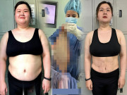 Làm đẹp - Chị em thời hiện đại giữ dáng: Ăn kiêng 0 đồng, chi trăm triệu thu nhỏ dạ dày