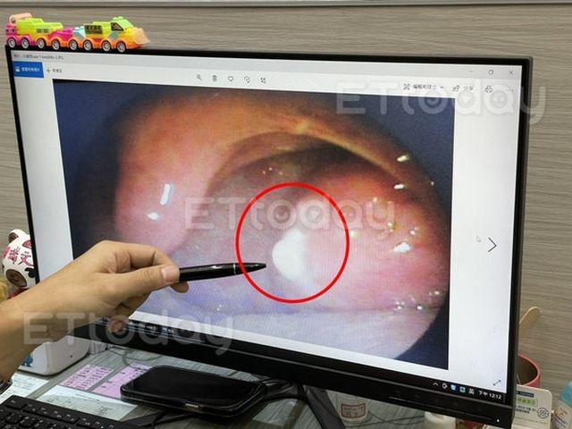 Vợ chê miệng chồng bốc mùi như trứng hỏng mỗi khi ngủ cùng, chồng cầu cứu bác sĩ - 2