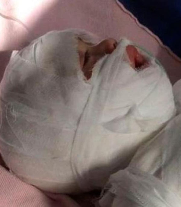 Mẹ kế thả con trai riêng của chồng vào bồn tắm đầy nước sôi chỉ vì một trận cãi nhau - 2