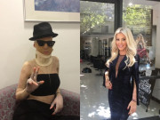 Tin tức - Người phụ nữ bị đánh ghen, tạt axit đến mức hủy hoại dung nhan 9 năm trước giờ ra sao?