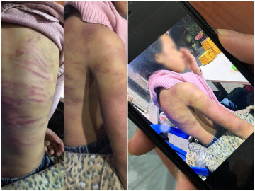 Lời kể của bé gái 12 tuổi nghi bị mẹ ruột và người tình bạo hành ở Hà Nội