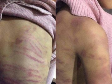 Gia cảnh éo le của bé gái bị mẹ đẻ bạo hành, nghi bị xâm hại tình dục