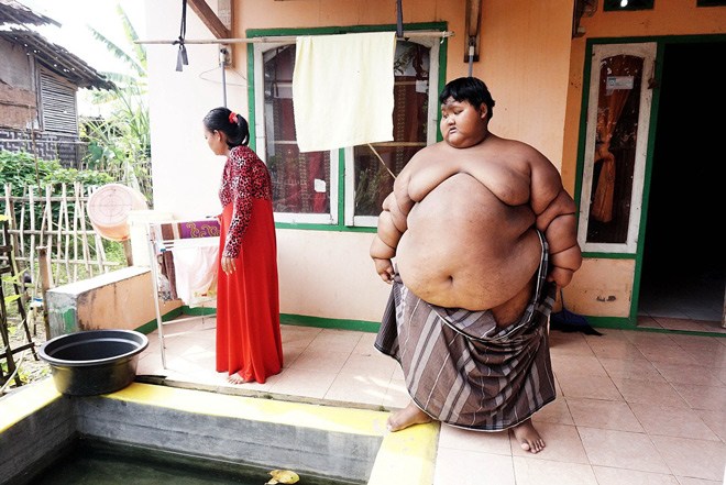 Cậu bé nặng cân nhất thế giới từng nặng gần 200kg thay đổi ngoạn mục sau 3 năm - 3