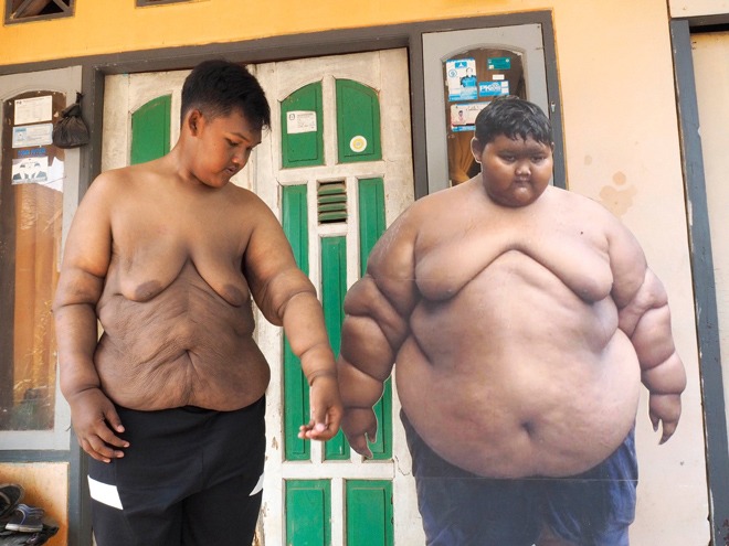 Cậu bé nặng cân nhất thế giới từng nặng gần 200kg thay đổi ngoạn mục sau 3 năm - 5