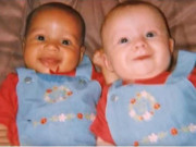 Tin tức - Cặp sinh đôi có ngoại hình hoàn toàn trái ngược khiến cả thế giới sửng sốt giờ ra sao?