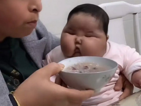 Mẹ hãnh diện nuôi con 5 tháng bụ bẫm, bác sĩ lắc đầu thông báo tin buồn