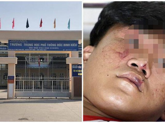 Vụ nhóm côn đồ xông vào trường học đánh đập dã man nam sinh: Hiệu trưởng nói gì?