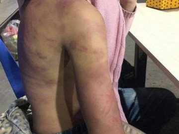 Vụ bé gái 12 tuổi nghi bị bạo hành, hiếp dâm: Hé lộ tuổi thơ "đặc biệt" của người mẹ