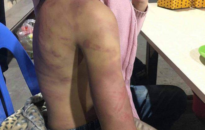 Vụ bé gái 12 tuổi nghi bị bạo hành, hiếp dâm: Hé lộ tuổi thơ amp;#34;đặc biệtamp;#34; của người mẹ - 1