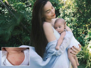 Làm mẹ - Hồ Ngọc Hà cầu cứu dân mạng vì con gái Lisa nổi mẩn đỏ khắp mặt và người