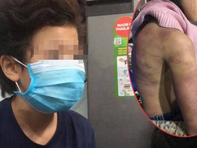 Bé gái 12 tuổi ở Hà Nội bị cha dượng” hiếp dâm, mẹ đẻ hành hạ giờ ra sao?