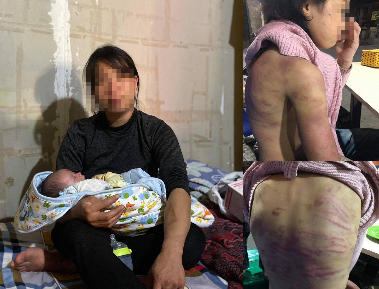 Bé gái 12 tuổi ở Hà Nội bị amp;#34;cha dượng” hiếp dâm, mẹ đẻ hành hạ giờ ra sao? - 2