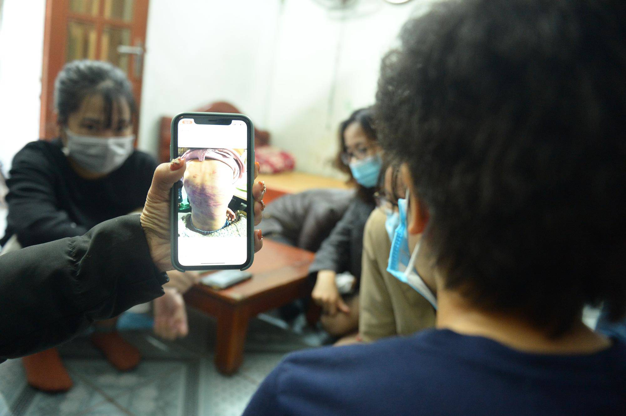 Bé gái 12 tuổi ở Hà Nội bị amp;#34;cha dượng” hiếp dâm, mẹ đẻ hành hạ giờ ra sao? - 1