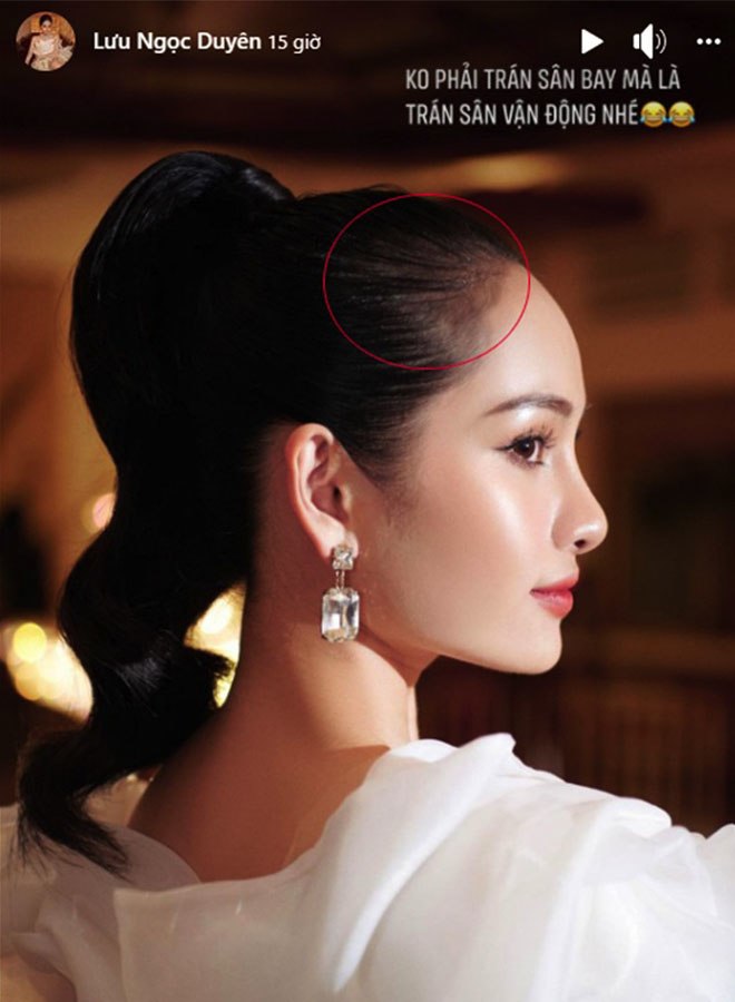 “Hồi teen” hậu sinh đôi, vợ trẻ Dương Khắc Linh đổi tóc giấu tiệt khuyết điểm - 5