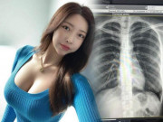 Làm đẹp - Dáng đẹp đến mức bị đồn cắt xương sườn “đại hot girl” phải chụp X quang chứng minh