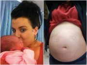 Sức khỏe - Mắc bệnh nhạy cảm không thể quan hệ bình thường, cô gái bất ngờ khi có bầu